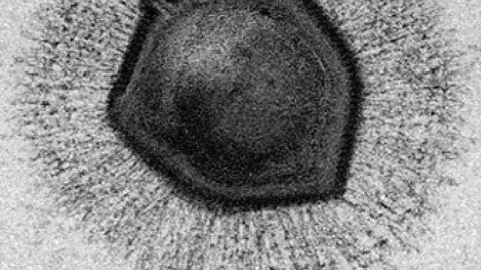 Fotografía con microscopio de barrido electrónico de una partícula de Mimivirus, un virus gigante.