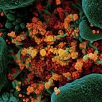Imagen del virus SARS-COV-2