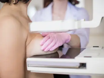 mamografía mamografía