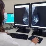 La esperanza de vida de una paciente con metástasis es de 4 o 5 años
