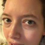 Jenny necesita una complicada operación para tratar de volver a levantarse de la cama