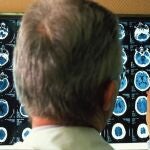 Un Doctor mira la radiografía de un derrame cerebral