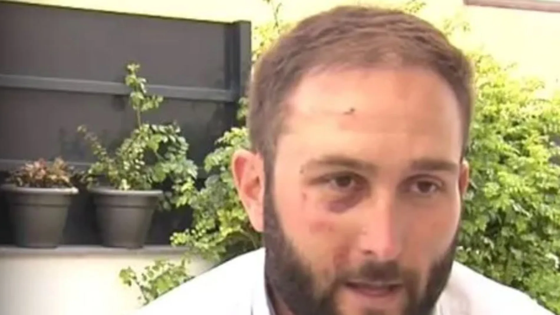 El ciclista agredido Raúl Márquez / Cuatro