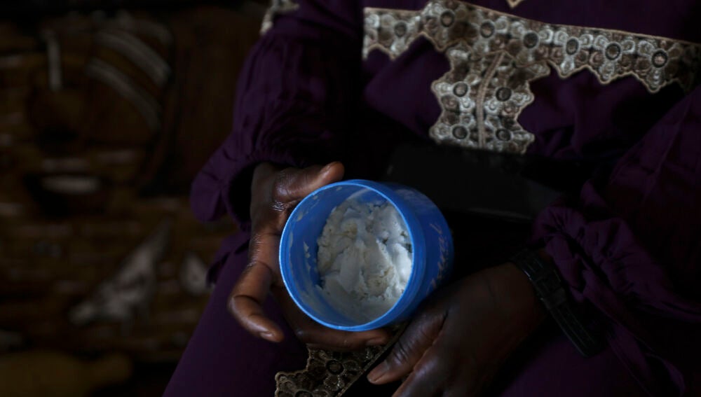 Pomada a base de manteca de karité, aceite de oliva y cola que fabrican para ayudar en la cicatrización.@Cipriano Pastrano