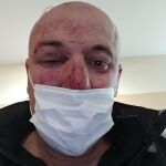 El hombre agredido este viernes en Linares por dos agentes de la Policía Nacional ha sufrido numerosas heridas