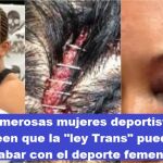 Numerosas mujeres deportistas creen que la "ley Trans" puede acabar con el deporte femenino