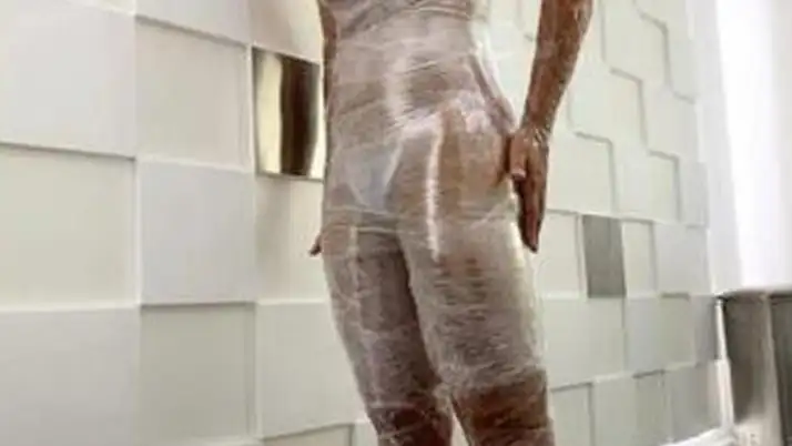 Nuria Roca durante el tratamiento de bioslimming