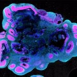 ¿POR QUÉ LOS HUMANOS TENEMOS EL CEREBRO TAN GRANDE?External and Third Party Use of MRC Laboratory of Molecular Biology (LMB) Images. ‘Scientists discover how humans develop largeDescubren por primera vez los motivos por los que nuestro volumen cerebral creció el triple que el de gorilas y chimpancésCaptions and credits for imagesFor media release: ‘Scientists discover how humans develop larger brains than other apes’ S.Benito-Kwiecinski/MRC LMB/Cell