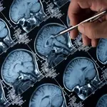 Esta enfermedad afecta a unas 350.000 personas en España