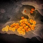 Esta imagen de microscopio electrónico de barrido muestra el SARS-CoV-2 (naranja), el virus que causa la COVID-19, aislado de un paciente en EE.UU