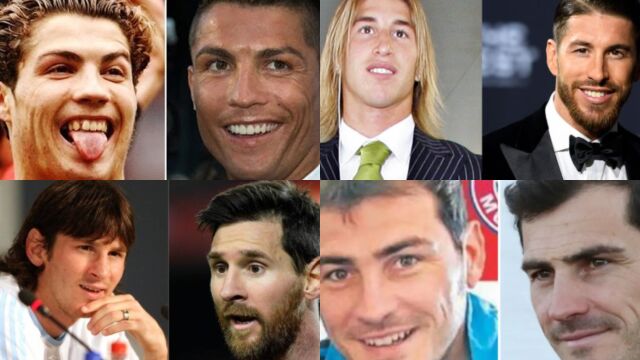 Retoques estéticos de los futbolistas