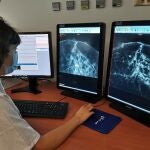 Estudio de mamografía