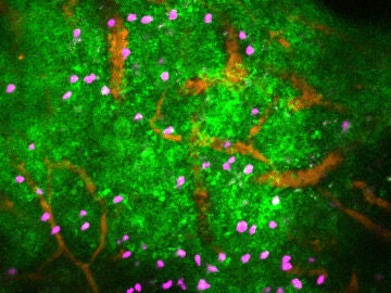 Imagen real mostrando los efectos de la noradrenalina. Los linfocitos se muestran en rosa, los vasos sangu&iacute;neos en naranja y en verde puede verse el calcio que act&uacute;a como se&ntilde;alizador.