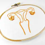 órgano reproductos femenino. Útero, ovariosFLIICKR/HEY PAUL STUDIOS (Foto de ARCHIVO)01/01/1970