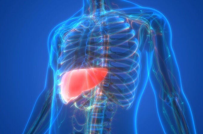 El colangiocarcinoma agrupa un conjunto heterogéneo de tumores que se desarrollan en los conductos biliares
