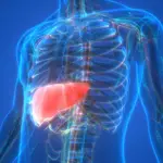 Enfermedad del hígado graso