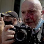 Ramón Espinosa tras resultar herido después de ser golpeado por la policía