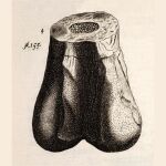 Imagen del Scrotum humanum