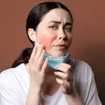 Rosácea mascarillas