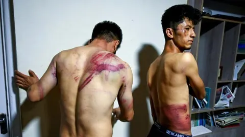 Los profesionales, al ser liberados, decidieron enseñar las marcas de las agresiones. @globalextra