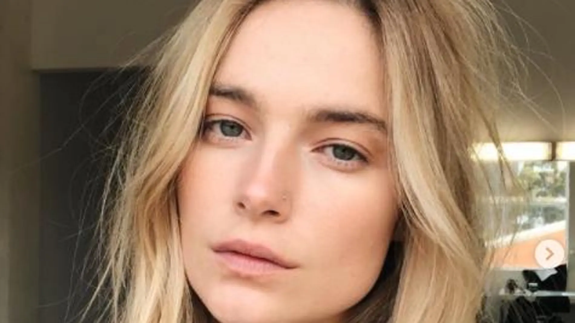 Bridget Malcolm puso en riesgo su salud para cumplir su sueño de ser una Ángel de Woman's Secret