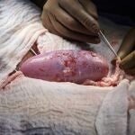 El riñón se encontraba en el exterior del cuerpo para poder observarlo