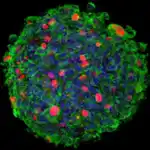 Imagen 3D de inmunomicroscopía confocal de una neuroesfera originada por células madre aisladas de un paciente de glioblastoma (GSC), e infectadas por el parvovirus MVM (Minute Virus of Mice)