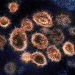 Virus del SARS-CoV-2