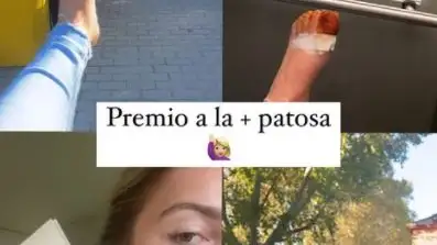 Imagen compartida por Sofía Bono, tras sufrir un accidente