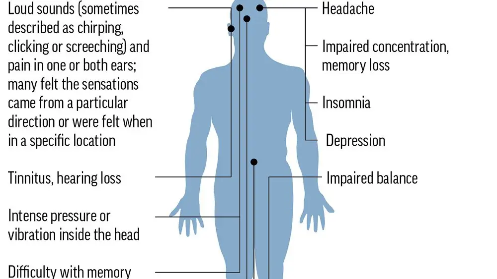 Symptoms associated with Havana syndrome, which has afflicted Americans serving at diplomatic posts in several countries. (AP Graphic)