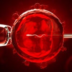 ¿Puede ser la Transferencia de Huso una solución a la infertilidad de la mujer relacionada con una edad avanzada?