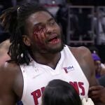 Isaiah Stewart, con el rostro ensangrentado después de la agresión de LeBron James.