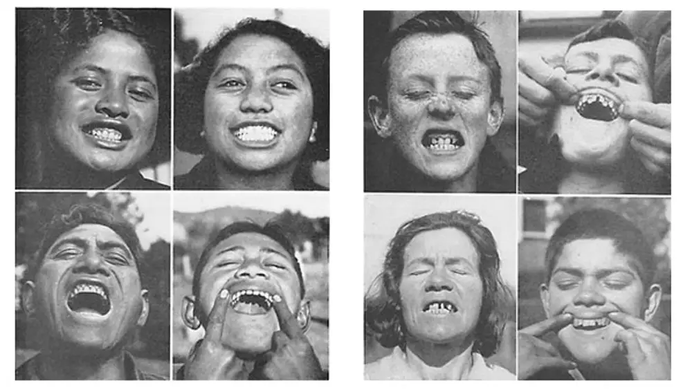 Fotografías de indígenas del libro “Nutrición y Degeneración Física”