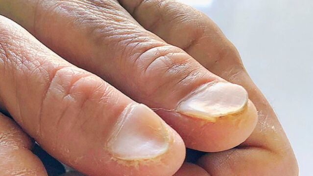 Uñas