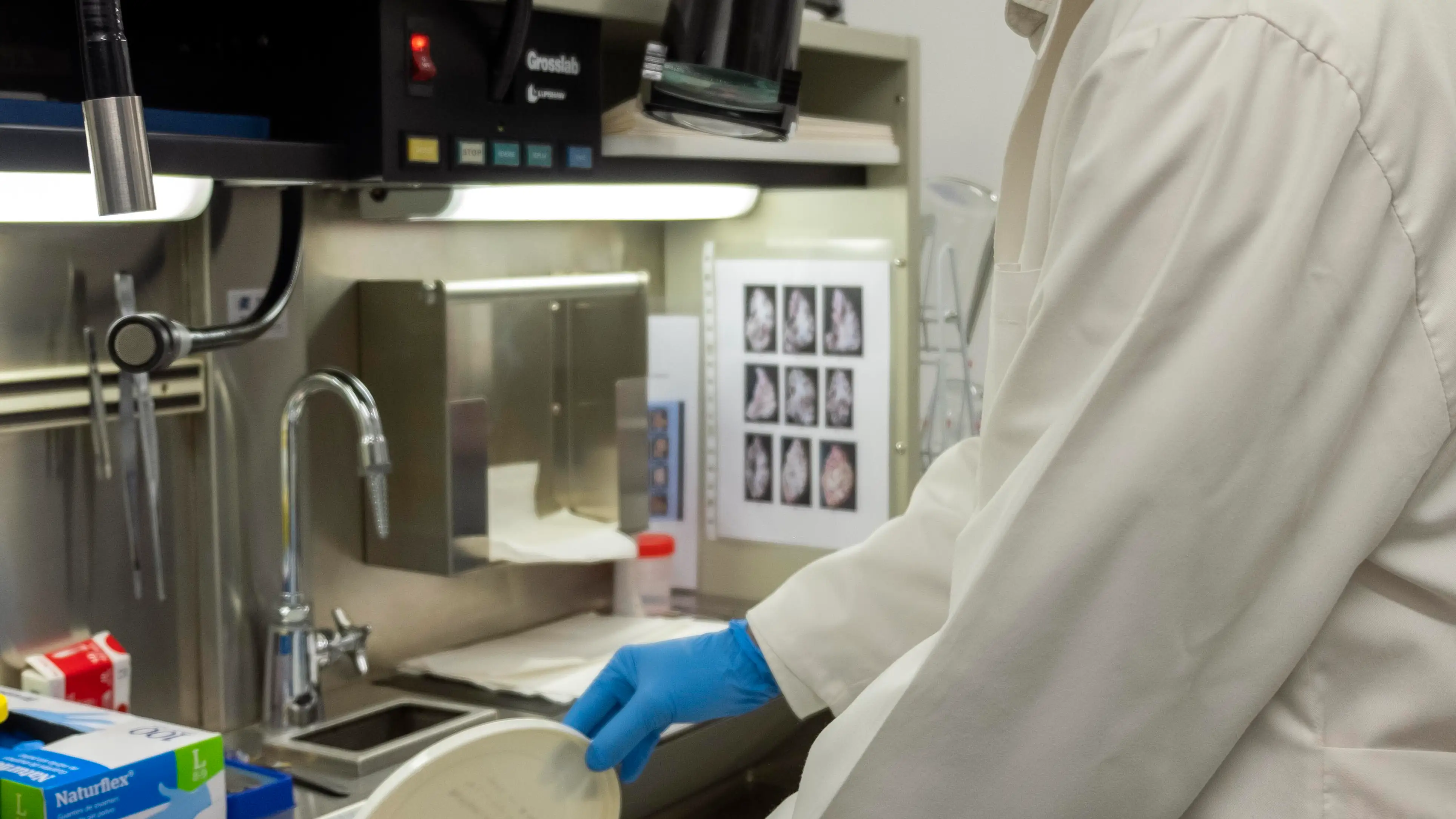 El banco de cerebros de Castilla y León está ubicado en el Incyl, en la universidad de Salamanca. Javier Herrero es el científico que lo dirige y se ocupa de su gestión