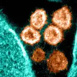 Con la mayor circulación de virus respiratorios aumentan los casos de coinfección