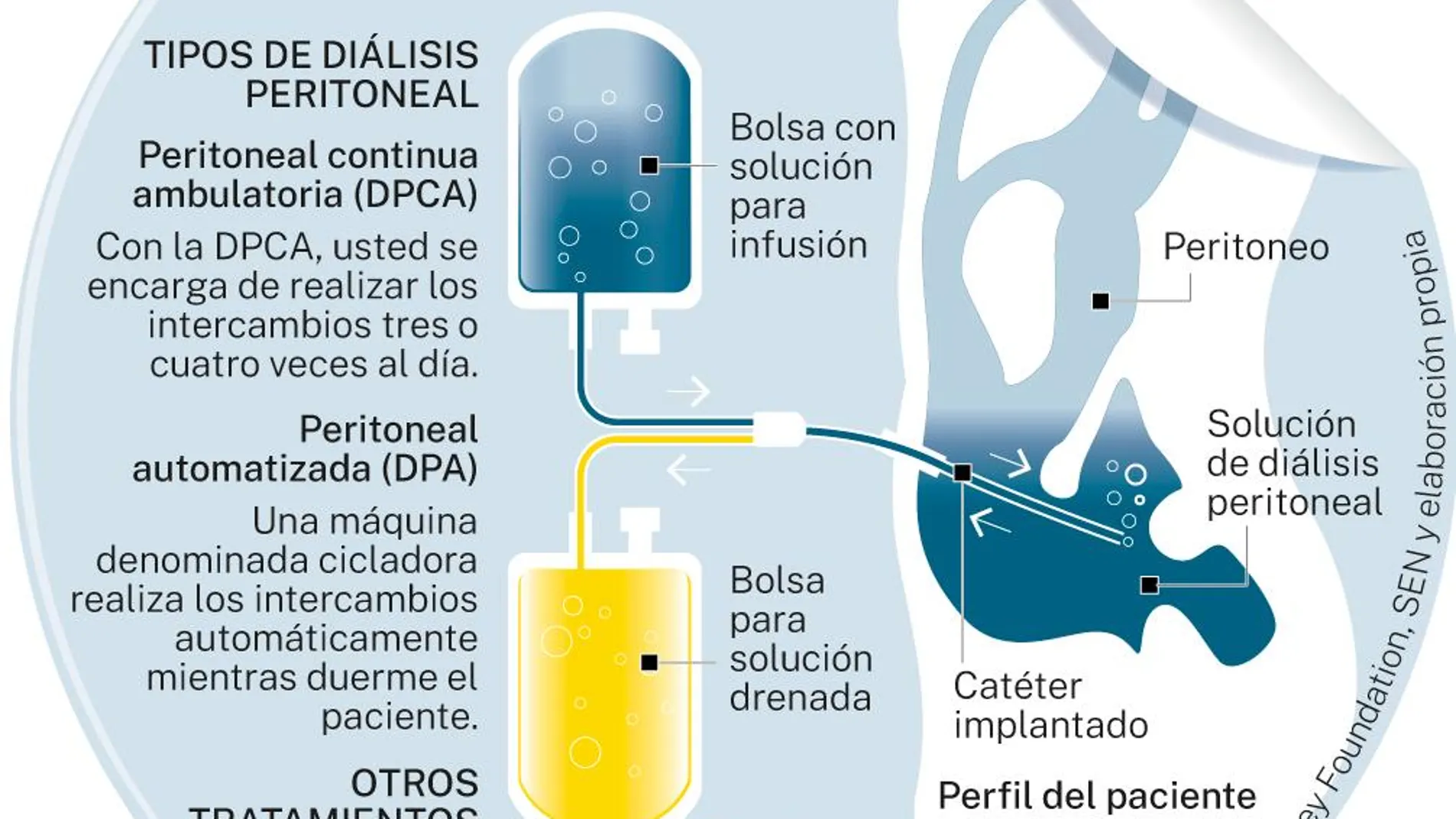 Infografía