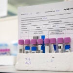 El laboratorio de las 500.000 PCR