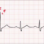 Electrocardiograma con precios altos