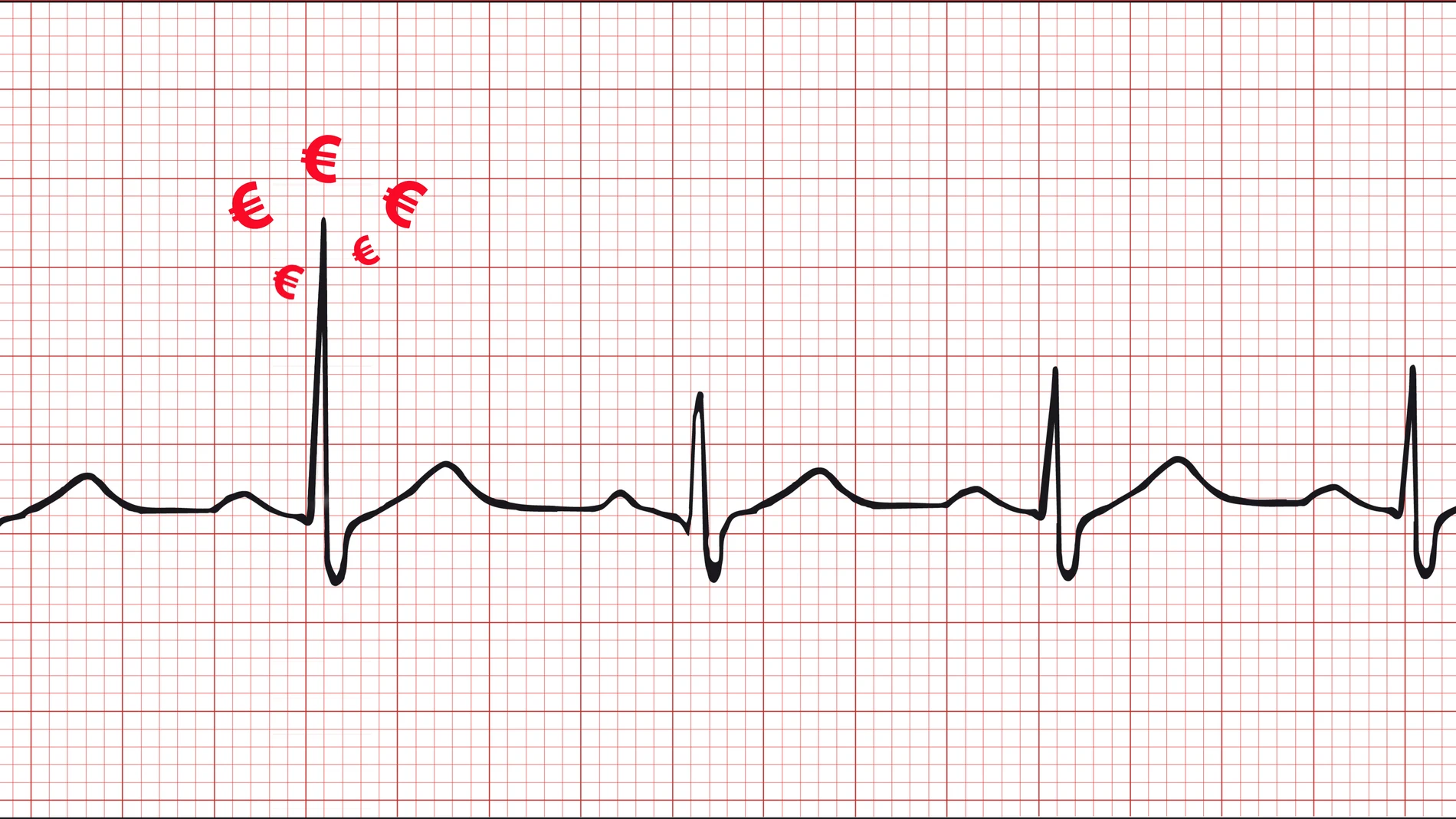 Electrocardiograma con precios altos