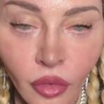 Nuevo rostro de Madonna