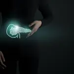 Cáncer de páncreas