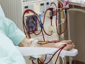 Dialisis