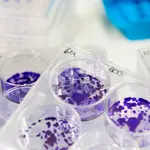 El uso de los inhibidores de PARP se ha mostrado eficaz en el tratamiento de los pacientes que sufren ciertos tipos de cáncer de ovario y el de mama, próstata y páncreas