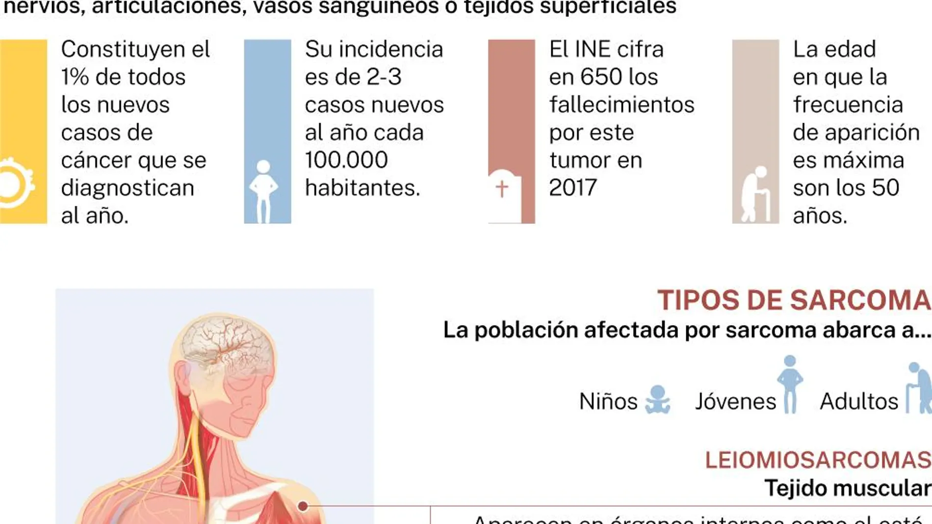 Infografía