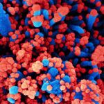 Micrografía electrónica de barrido de células humanas (azul) infectadas con SARS-CoV-2 (rojo)