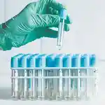 Los casos se han detectado en 10 comunidades autónomas