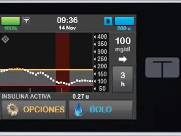 Bomba de insulina Bomba de insulina