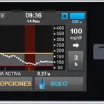 Bomba de insulina de Tandem Diabetes Care™ con tecnología Basal-IQ Carlsbad v6.4