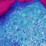 Imagen ampliada con un microscopio de una muestra de piel de un mono infectado con el virus de la viruela del mono, que los yihadistas atribuyen a un castigo de Alá, como el COVID (Efe)